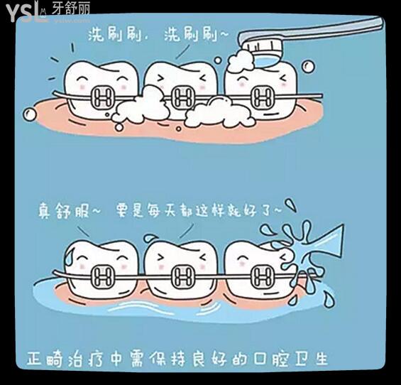 12歲兒童牙齒矯正費用是多少 牙齒矯正時應注意些什么呢.jpg