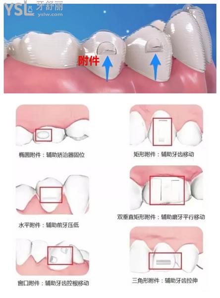 附件的類(lèi)型