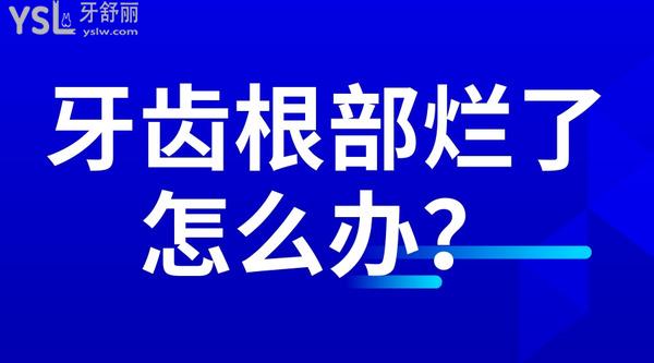 牙齒根部爛了怎么辦？