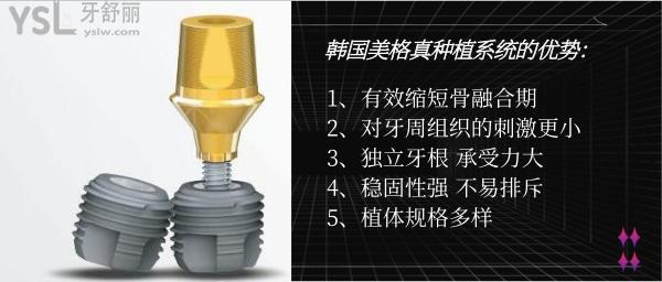 韓國種植體三個品牌有哪些.jpg
