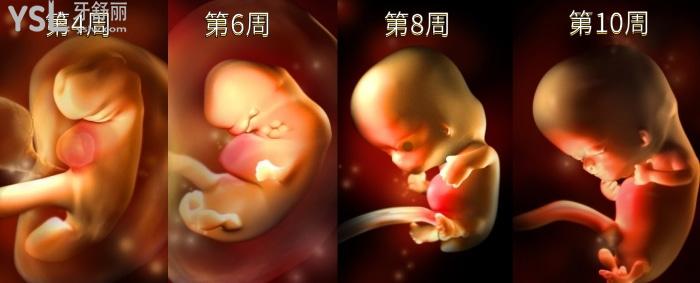腭裂唇是什么原因，如何預(yù)防？.jpg