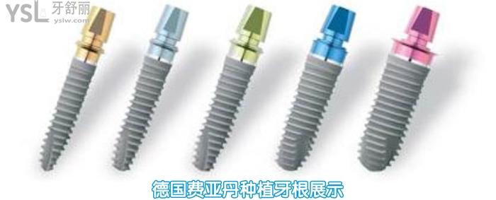 去北京西諾做德系種植牙多少錢，如何選擇種植牙告訴你.jpg