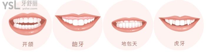 成人盡量不要矯正牙齒？究竟是有風(fēng)險(xiǎn)還是怕你<span style=