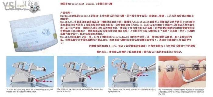 金屬自鎖和陶瓷自鎖哪個(gè)好，有哪些牌子求推薦！.jpg