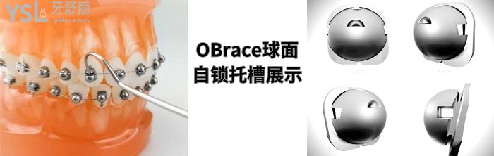 金屬自鎖和陶瓷自鎖哪個(gè)好，有哪些牌子求推薦！.jpg