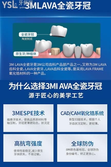 美國(guó)3M lawe全瓷牙特點(diǎn)