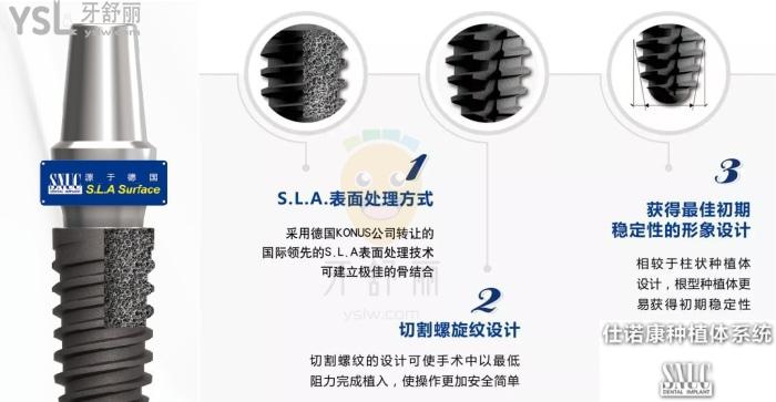 韓國仕諾康和奧齒泰哪個好？看完對比再做種植牙也不遲！.jpg
