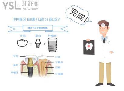 沈陽(yáng)種植牙多少錢 沈陽(yáng)又好又便宜牙科