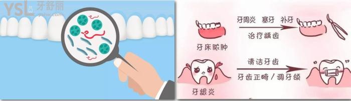 長期口氣臭是什么原因？怎么辦治療好？