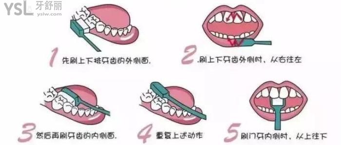 長期口氣臭是什么原因？怎么辦治療好？