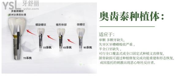 韓國(guó)奧齒泰種植體