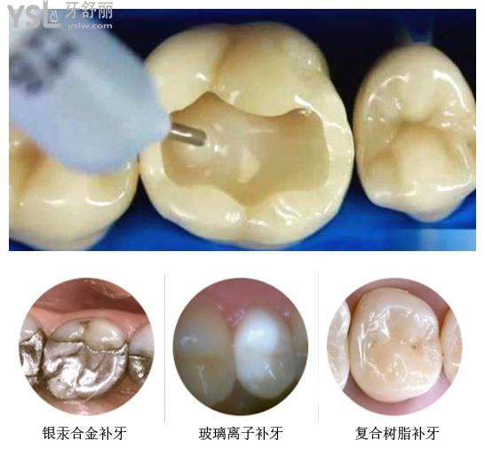 沈陽渾南區(qū)補牙去哪個牙科便宜