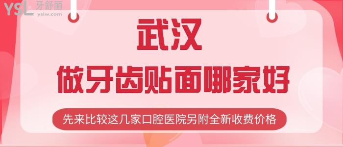 武漢做牙齒貼面哪家好？先來比較這幾家口腔醫(yī)院另附全新收費價格