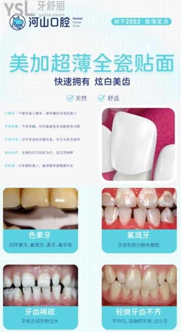 深圳世紀河山口腔牙貼面優(yōu)勢