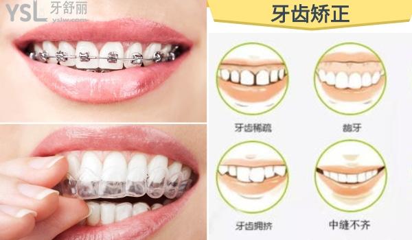 牙齒矯正