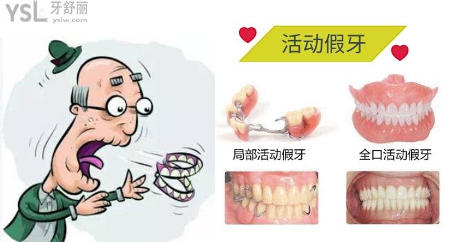 活動假牙