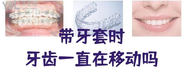帶牙套牙齒一直在移動嗎