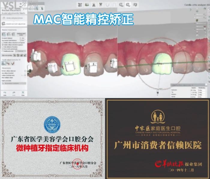 廣州中家醫(yī)家庭醫(yī)生口腔做隱型矯正嗎？多少錢？哪個醫(yī)生好？