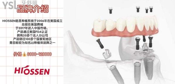 美國進(jìn)口種植體多少錢，美國hiossen種植體怎么樣