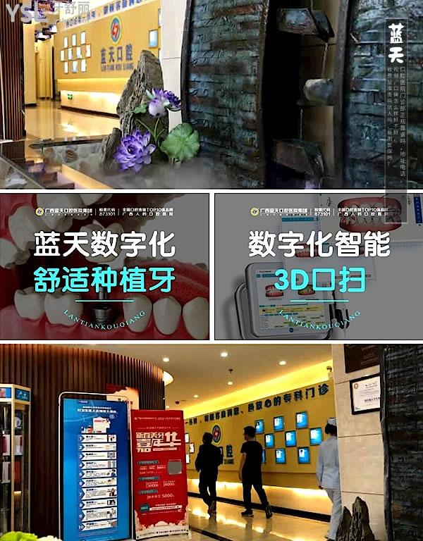 北流藍天口腔醫(yī)院正規(guī)靠譜嗎
