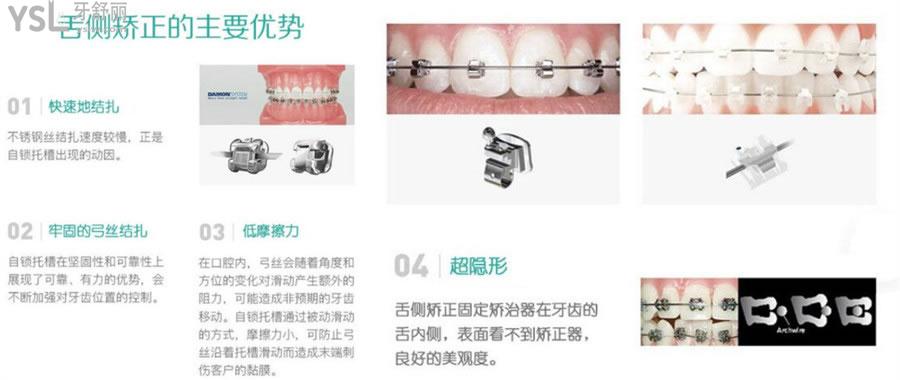 西安畫(huà)美團(tuán)圓口腔醫(yī)院價(jià)目表