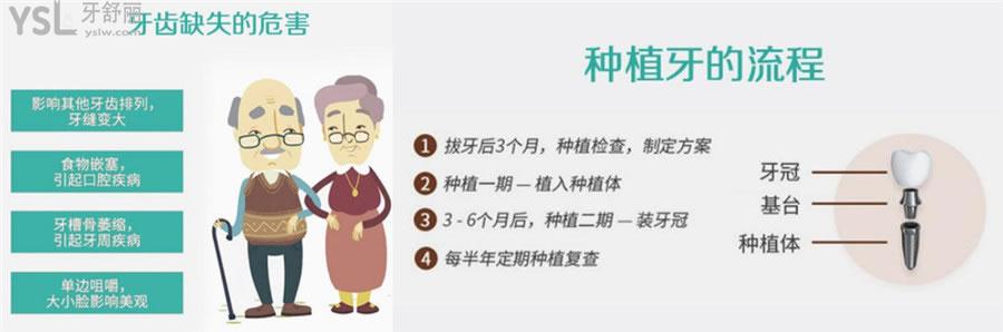西安畫(huà)美團(tuán)圓口腔醫(yī)院價(jià)目表