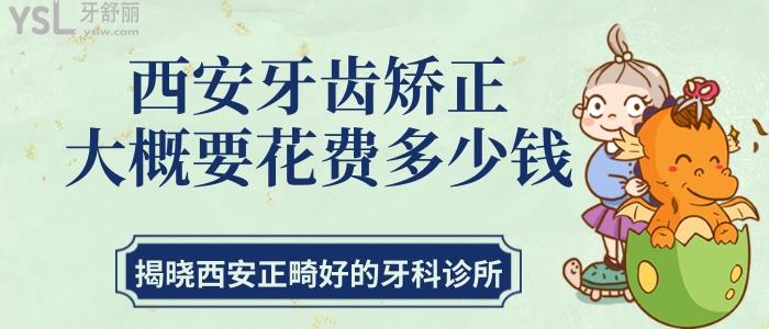 西安牙齒矯正大概要花費(fèi)多少錢 揭曉西安正畸好的牙科診所