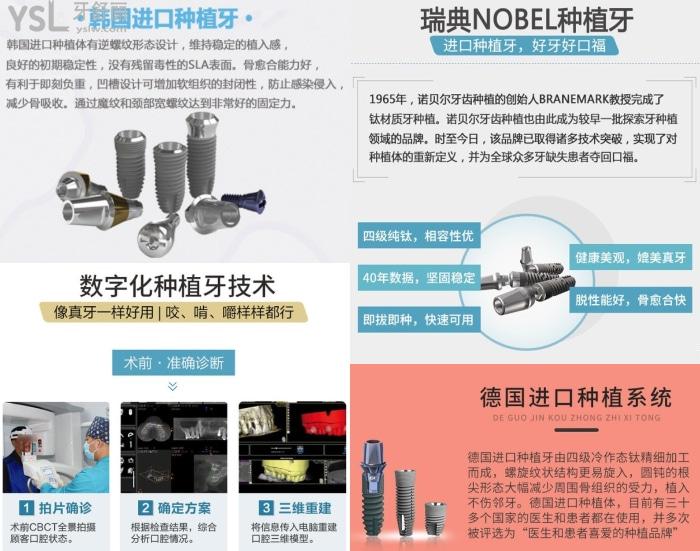 重慶團(tuán)圓口腔種植牙價(jià)格公布！親民價(jià)還好用！附收費(fèi)價(jià)格表！