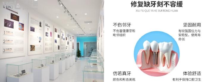 重慶團(tuán)圓口腔種植牙價(jià)格公布！親民價(jià)還好用！附收費(fèi)價(jià)格表！