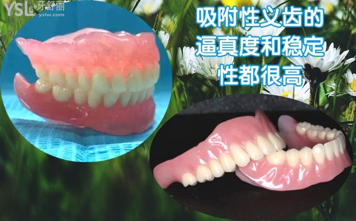 bps全口吸附性義齒價格多少錢？與普通活動義齒的區(qū)別大嗎？