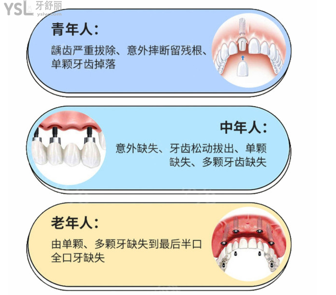 想知道在?？诜N全口牙需要多少錢？看完這份?？谘揽剖召M價目表輕松了解！