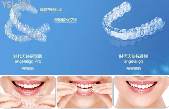 珠海隱形牙套哪家醫(yī)院比較好?推薦暨博口腔技術(shù)好價(jià)不高!