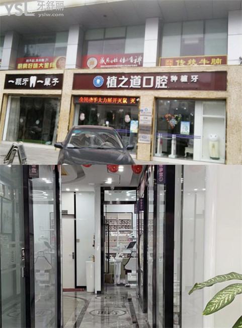?？谥仓揽谇环N牙怎么樣