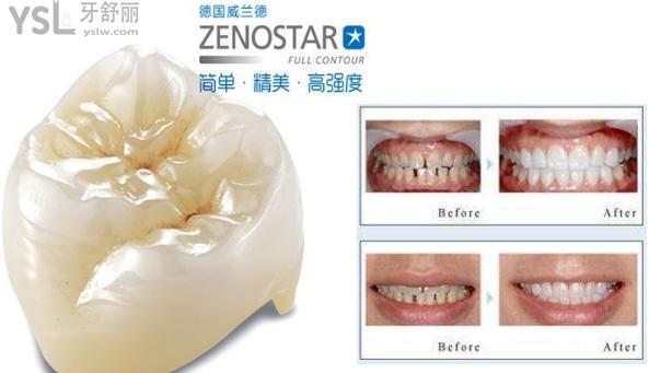 威蘭德臻瓷2400貴不貴，威蘭德臻瓷官方價格
