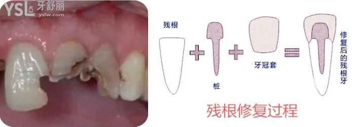 爛牙根