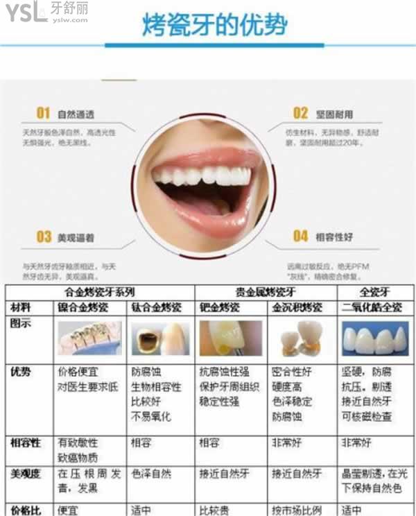 北京各口腔醫(yī)院鑲牙價格表，做烤/全瓷牙冠多少錢一顆