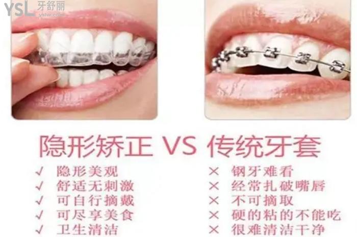 隱形矯正和金屬矯正哪個(gè)好？看好兩者區(qū)別做矯正事半功倍！