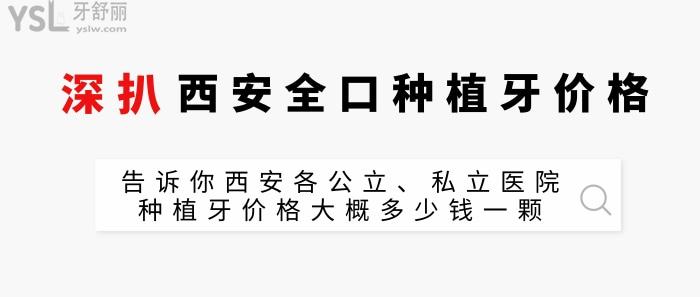 西安的全口種植牙價(jià)格表