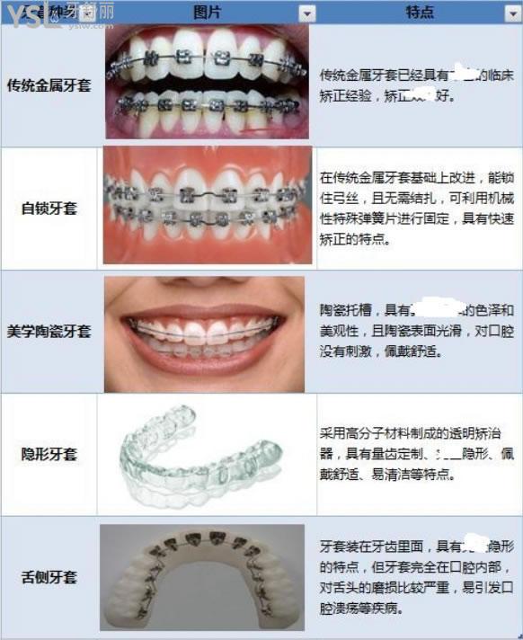 長沙補牙齒哪家醫(yī)院好