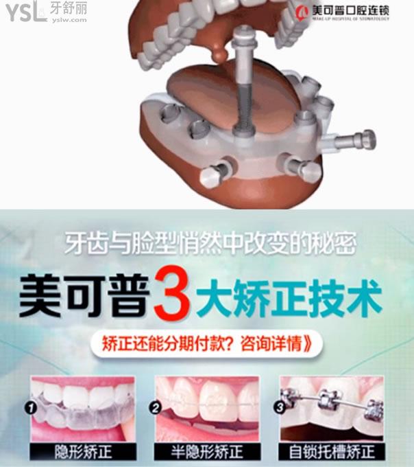 福州美可普口腔醫(yī)院牙齒矯正和種植牙技術優(yōu)勢