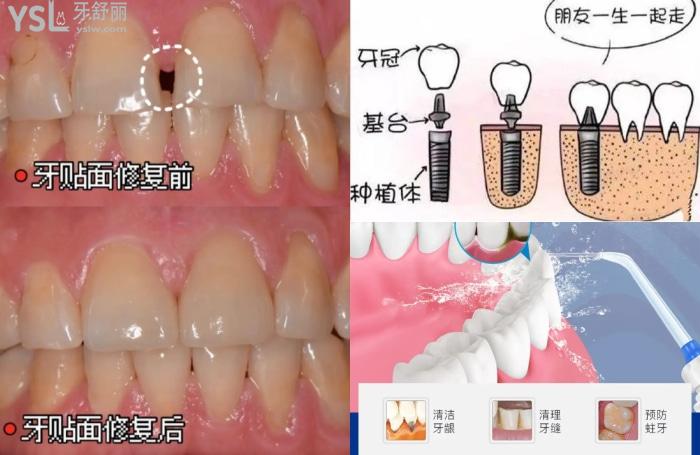 廣州看牙齒有哪些醫(yī)院推薦？看看廣州十大牙科醫(yī)院排名！看的好又便宜！