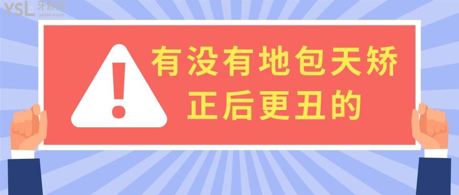 聊聊有沒(méi)有地包天矯正后更丑的，不看后悔錢白花了