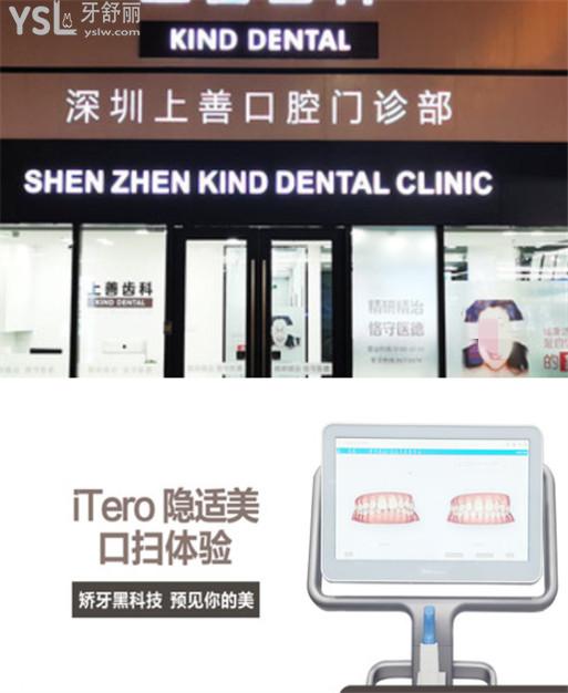 深圳上善齒科收費標準價格表