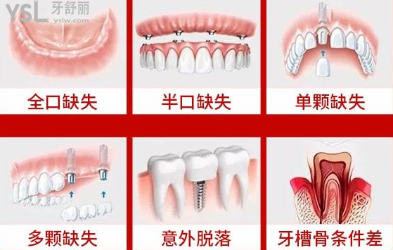 請把這條大數(shù)據(jù)推給缺牙的人，福州維樂口腔醫(yī)院幫助缺牙人士重拾口福！