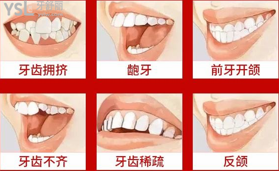請把這條大數(shù)據(jù)推給缺牙的人，福州維樂口腔醫(yī)院幫助缺牙人士重拾口福！
