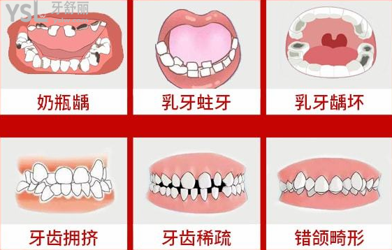 請把這條大數(shù)據(jù)推給缺牙的人，福州維樂口腔醫(yī)院幫助缺牙人士重拾口福！