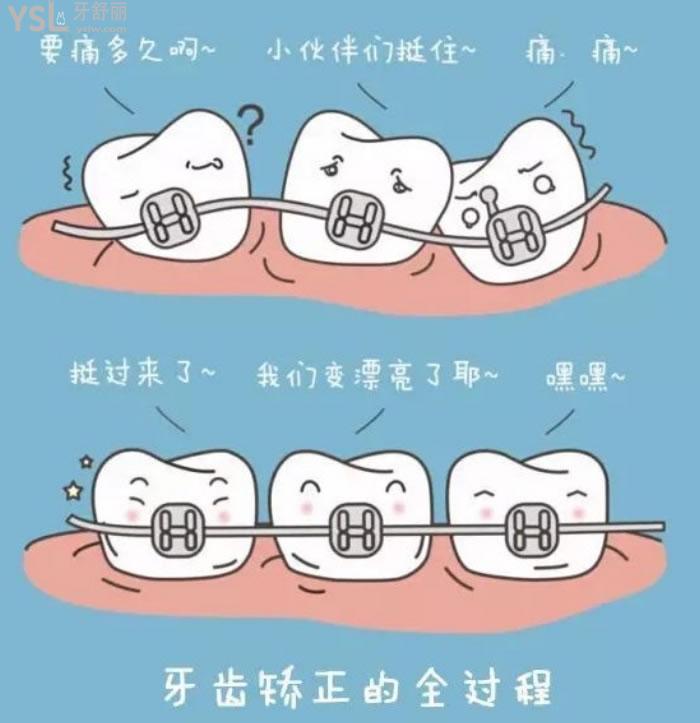 昆明隱形牙套矯正價(jià)格表