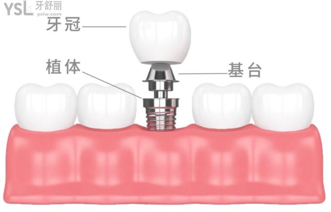達芬奇口腔連鎖活動