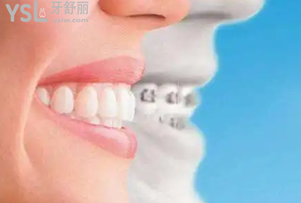 福建晉江金榜口腔醫(yī)院進(jìn)口隱形矯正立減10000元！