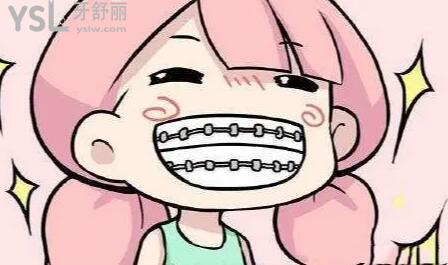 戴上牙套后多久可以正常吃東西及如何正確的護理牙齒！.jpg